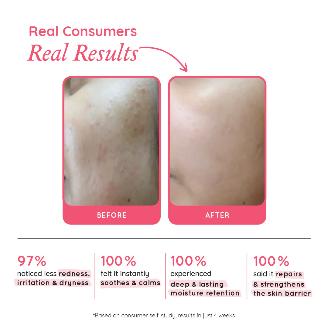 Barrier Repair & Restore Moisturiser - Image 4