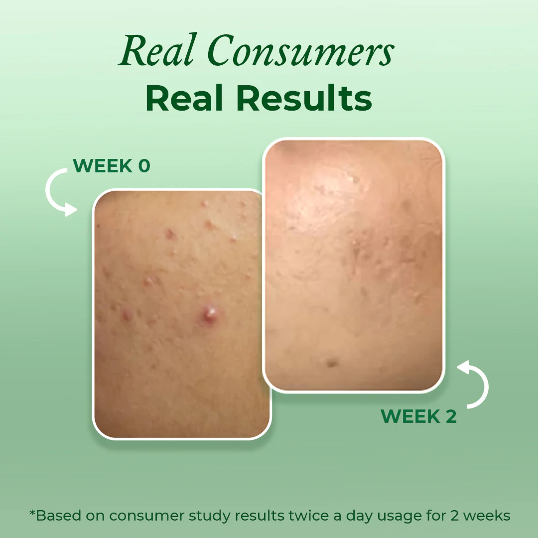 Clearing & Calming Acne Face Wash - Image 4