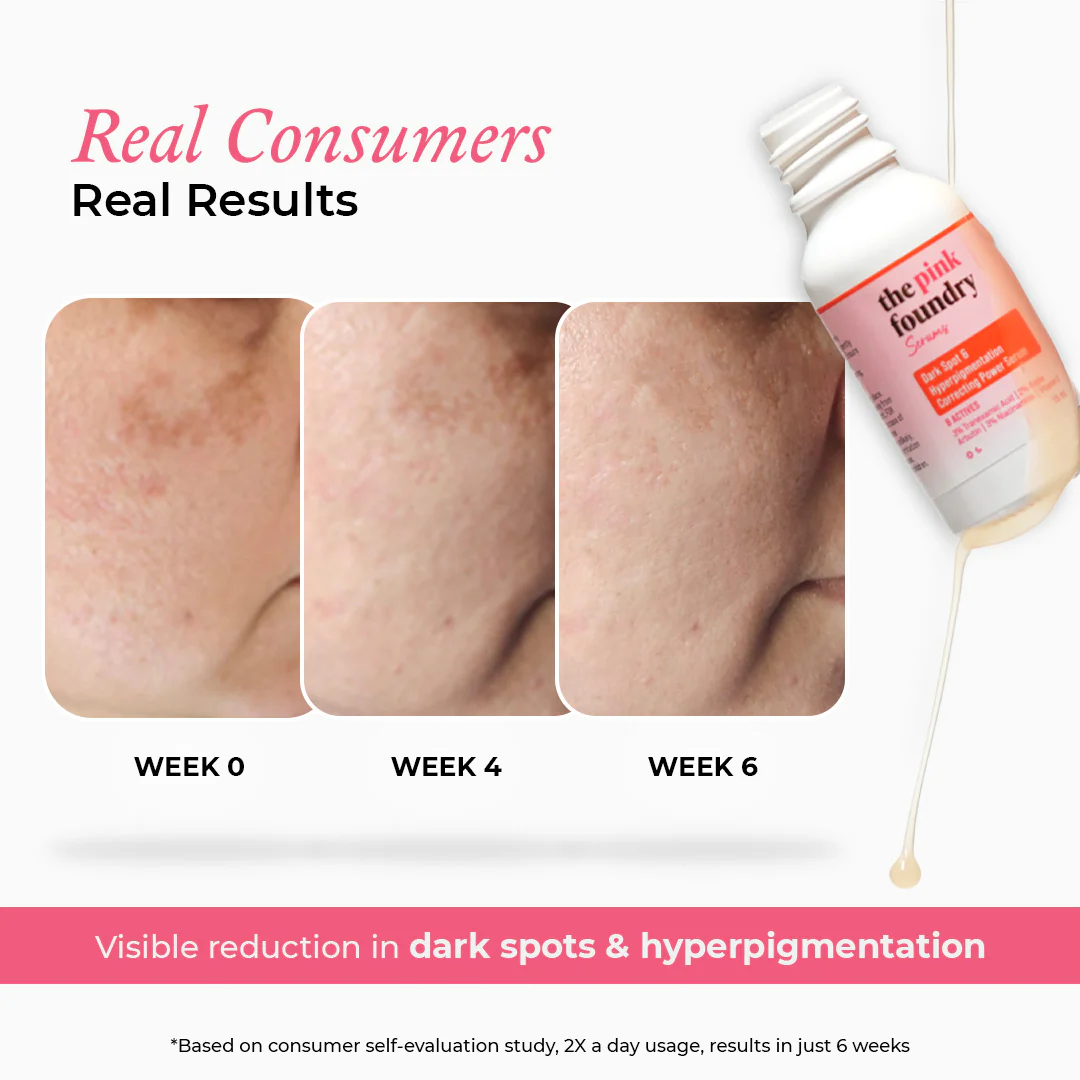 Mini Dark Spot & Hyperpigmentation Correcting Power Serum - Image 4