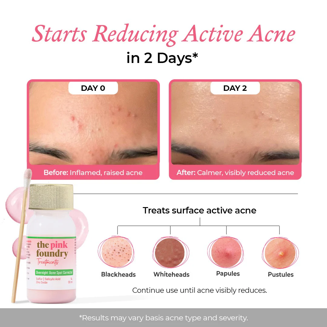 Overnight Acne Spot Corrector for Men 30 ml - Image 2