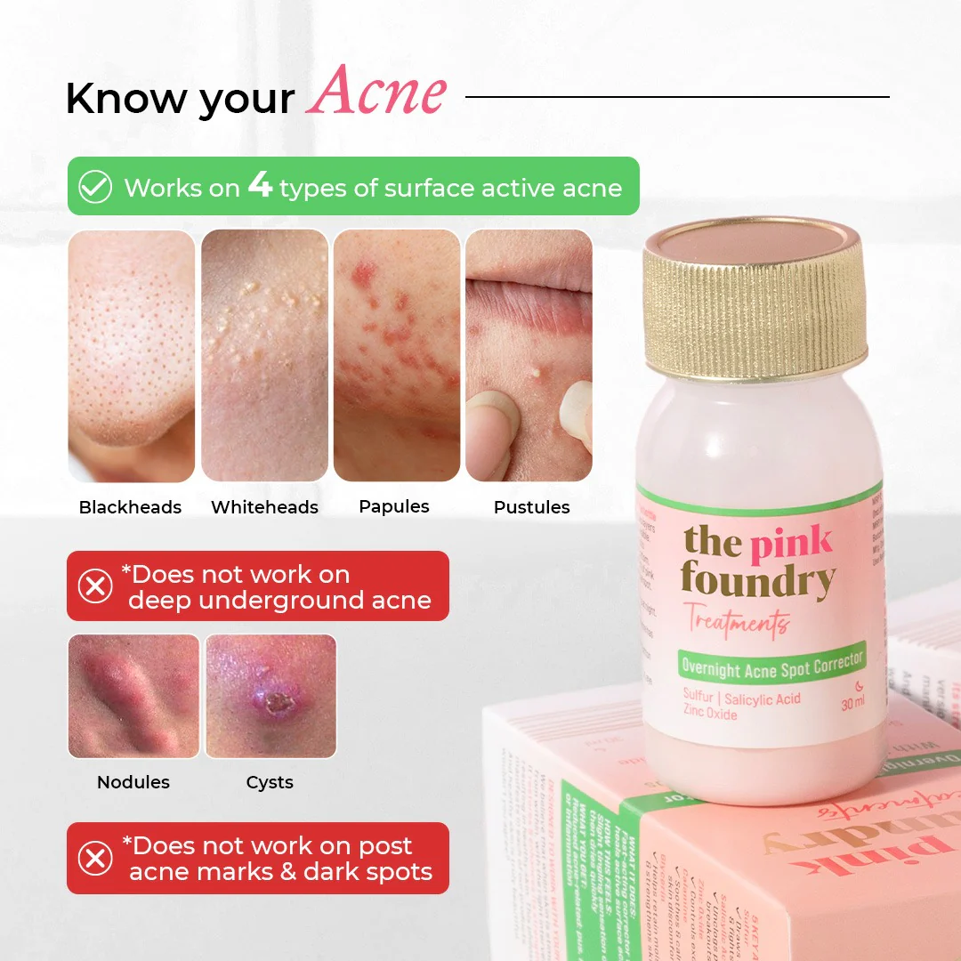 Overnight Acne Spot Corrector for Men 30 ml - Image 3