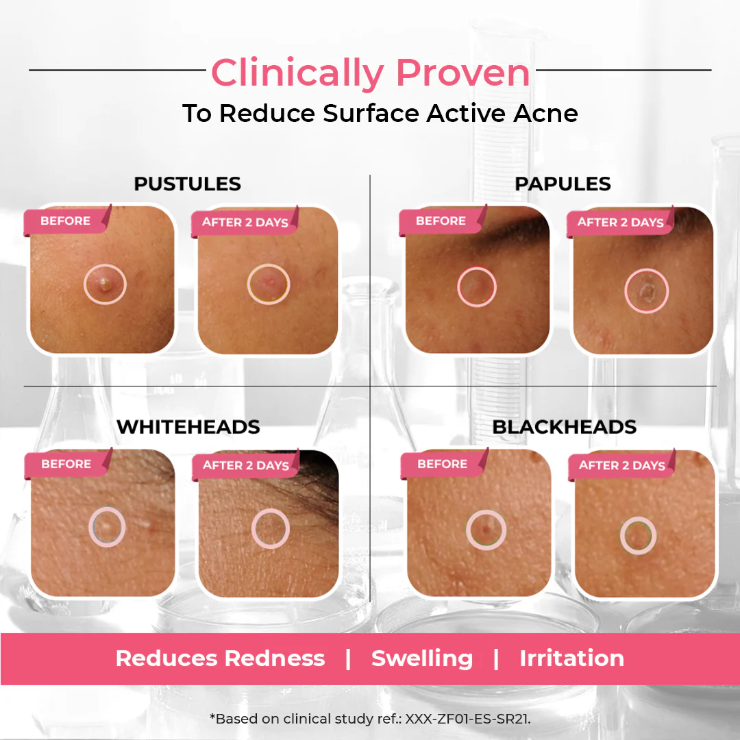 Overnight Acne Spot Corrector 30 ml - Image 6