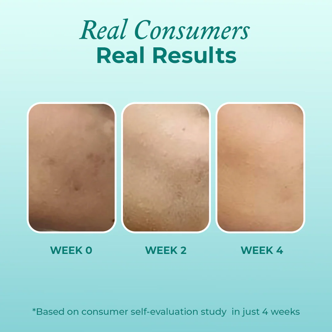 Super Clarifying 12% Niacinamide Face Serum - Image 7