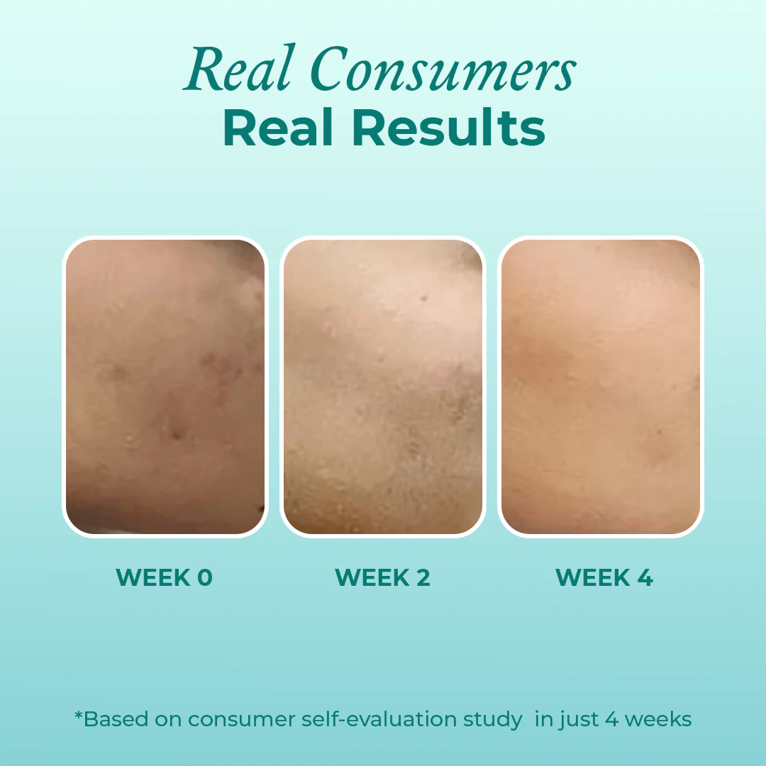 Mini Super Clarifying 12% Niacinamide Face Serum - Image 6