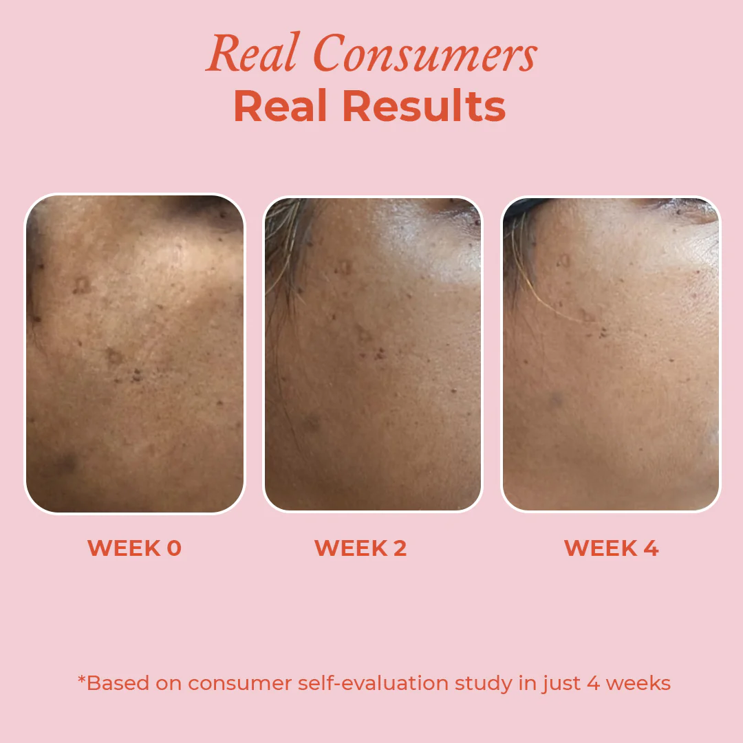 15% Vitamin C Brightening Serum - Image 5